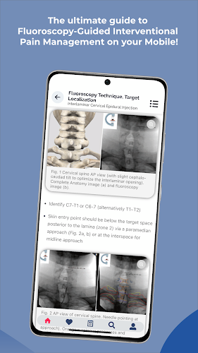 Interventional Pain App Captura de tela 3