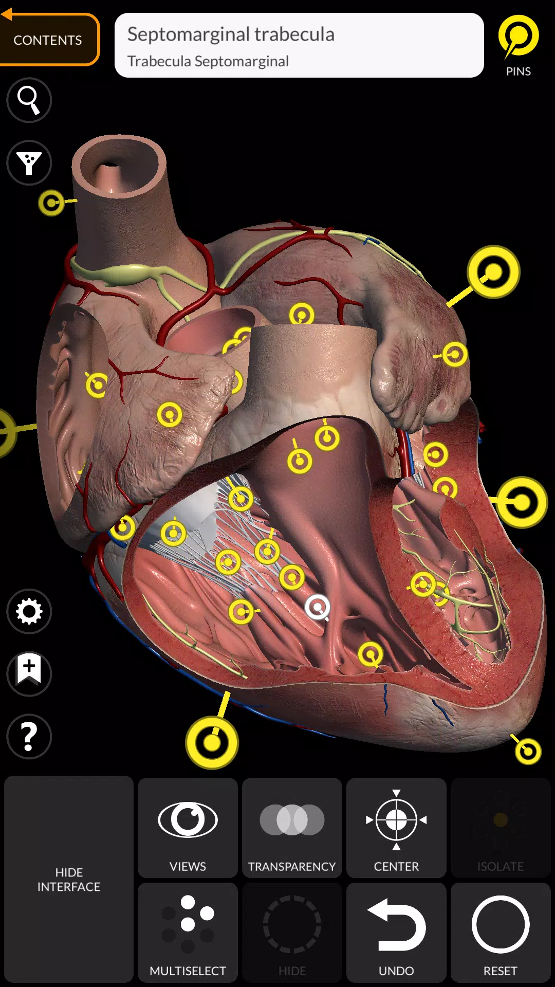 Anatomy 3D Atlas应用截图第2张