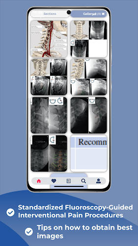 Interventional Pain App Tangkapan skrin 2